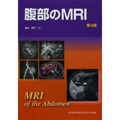 腹部のＭＲＩ　第３版