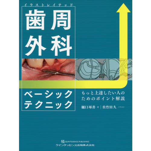 イラストレイテッド歯周外科ベーシックテクニック もっと上達したい人