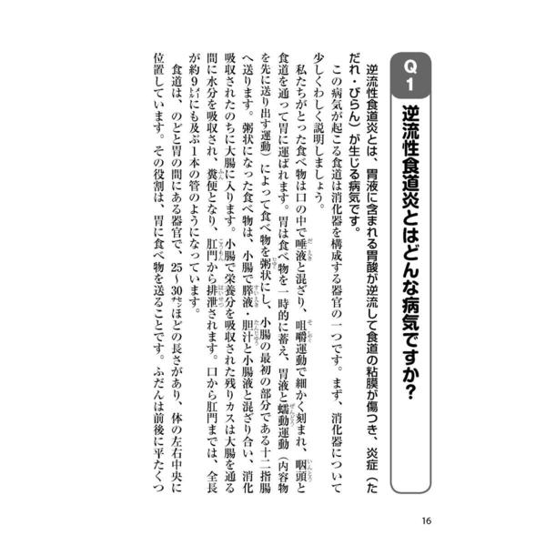 逆流性食道炎 消化器科の名医が教える最高の治し方大全 通販｜セブン