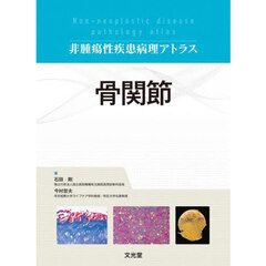 骨関節
