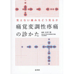 痛覚変調性疼痛の診かた　見えない痛みをどう見るか