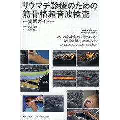 リウマチ診療のための筋骨格超音波検査