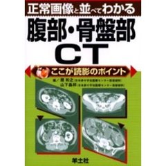 正常画像と並べてわかる腹部・骨盤部ＣＴ