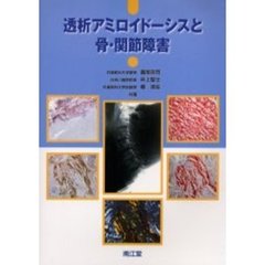 透析アミロイドーシスと骨・関節障害