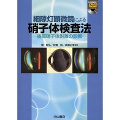 細隙灯顕微鏡による硝子体検査法 後部硝子体剥離の診断 梯彰弘