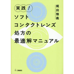 実践！ソフトコンタクトレンズ処方の最適解マニュアル