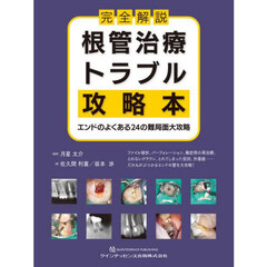 完全解説根管治療トラブル攻略本　エンドのよくある２４の難局面大攻略