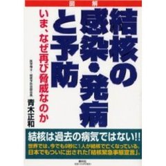 結核の感染・発病と予防　いま、なぜ再び脅威なのか