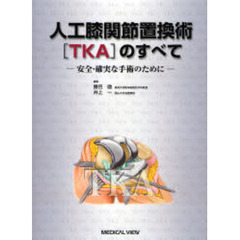人工膝関節置換術〈ＴＫＡ〉のすべて　安全・確実な手術のために