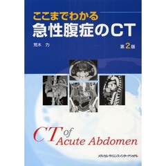 ここまでわかる急性腹症のＣＴ　第２版