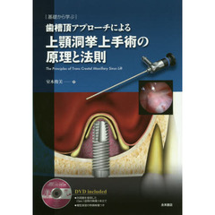 歯槽頂アプローチによる上顎洞挙上手術の原理と法則　基礎から学ぶ