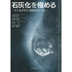 石灰化を極める　マンモグラフィ石灰化アトラス