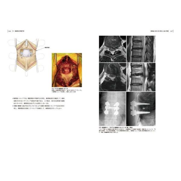楽天ブックス: 頚椎・胸椎の手術［DVD付］ - 鐙 邦芳
