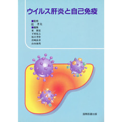 ウイルス肝炎と自己免疫
