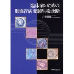 臨床家のための肺血管病変肺生検診断