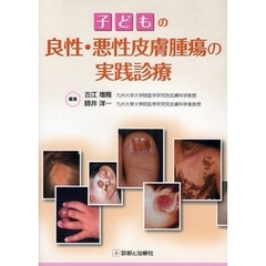 子どもの良性・悪性皮膚腫瘍の実践診療