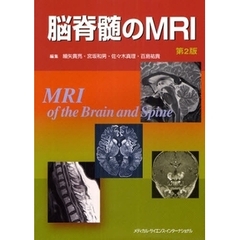 脳脊髄のＭＲＩ　第２版