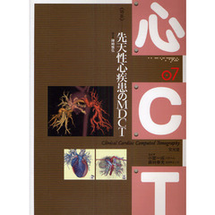 心ＣＴ　０７　〈特集〉先天性心疾患のＭＤＣＴ