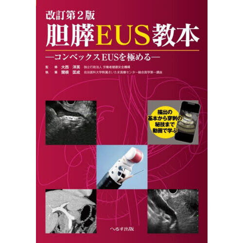 セブンネットショッピングで買える「胆膵EUS教本 コンベックスEUSを極める 描出の基本から穿刺の秘技まで動画で学ぶ 改訂第2版」の画像です。価格は5,720円になります。