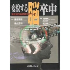 変貌する脳卒中　無症候性脳梗塞をめぐって