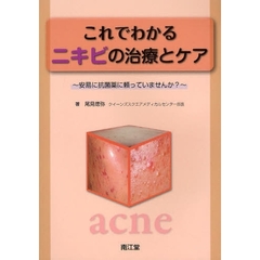 これでわかるニキビの治療とケア　安易に抗菌薬に頼っていませんか？