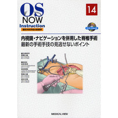 内視鏡・ナビゲーションを併用した脊椎手術　最新の手術手技の見逃せないポイント