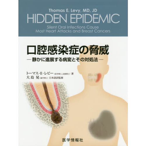 口腔感染症の脅威: 静かに進展する病変とその対処法 口腔感染症の脅威: 静かに進展する病変とその対処法 口腔感染