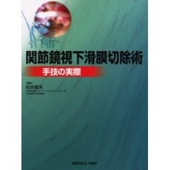 関節鏡視下滑膜切除術　手技の実際