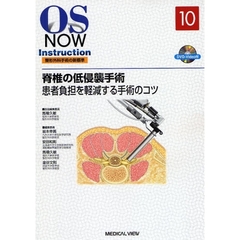 脊椎の低侵襲手術　患者負担を軽減する手術のコツ