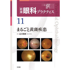 新篇眼科プラクティス　１１　まるごと黄斑疾患