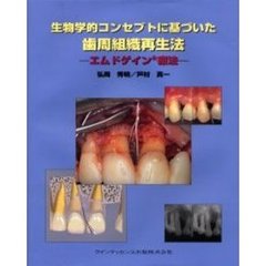 生物学的コンセプトに基づいた歯周組織再生法　エムドゲイン療法