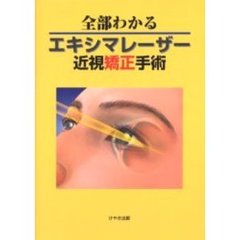 全部わかるエキシマレーザー近視矯正手術