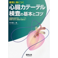 確実に身につく心臓カテーテル検査の基本とコツ　冠動脈造影所見＋シェーマで，血管の走行と病変が読める！