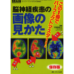 脳神経疾患の画像の見かた　この１冊でパーフェクトマスター！　保存版