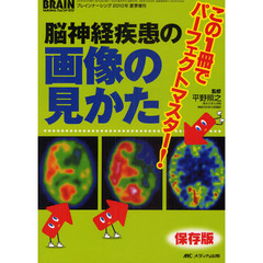 脳神経疾患の画像の見かた　この１冊でパーフェクトマスター！　保存版