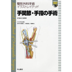 手関節・手指の手術