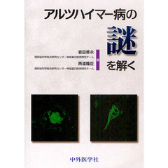 アルツハイマー病の謎を解く