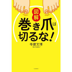 図解巻き爪は切るな！