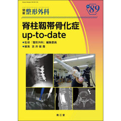 脊柱靱帯骨化症ｕｐ－ｔｏ－ｄａｔｅ