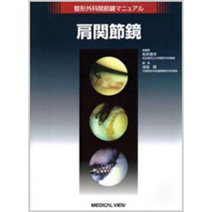肩関節鏡