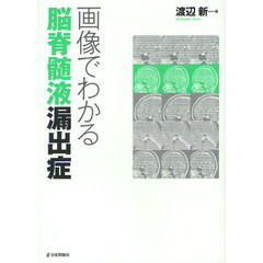 画像でわかる脳脊髄液漏出症