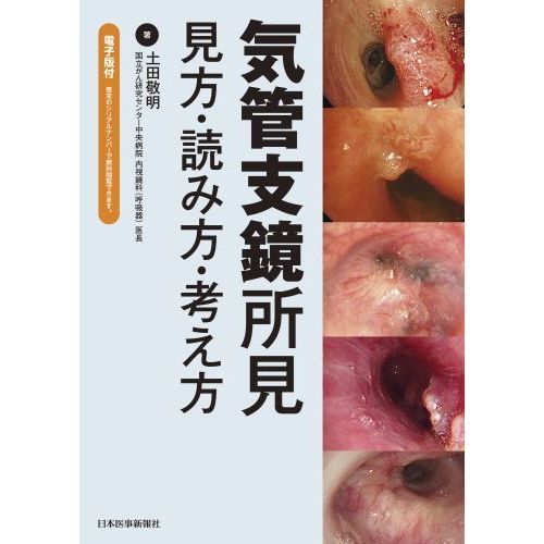 気管支鏡所見 見方・読み方・考え方 通販｜セブンネットショッピング