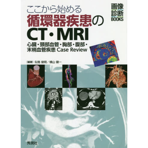 ここから始める循環器疾患のCT・MRI 心臓・頸部血管・胸部・腹部