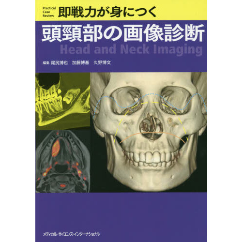 即戦力が身につく頭頸部の画像診断 | 尾尻博也, 加藤博基, 久野