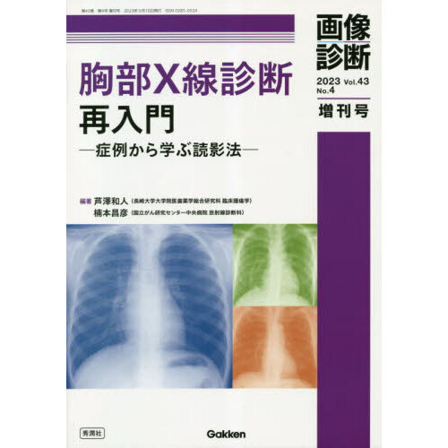 胸部X線診断再入門: 症例から学ぶ読影法 胸部X線診断再入門 症例から学ぶ読影法 通販｜セブンネット