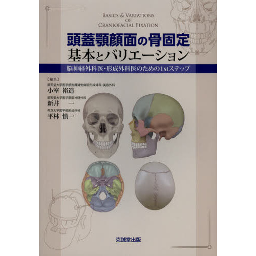 頭蓋顎顔面の骨固定基本とバリエーション　脳神経外科医・形成外科医のための１ｓｔステップ