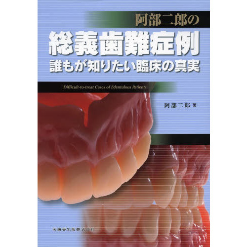 阿部二郎の総義歯難症例 誰もが知りたい臨床の真実 通販｜セブンネット 