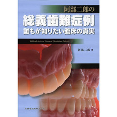 阿部二郎の総義歯難症例　誰もが知りたい臨床の真実