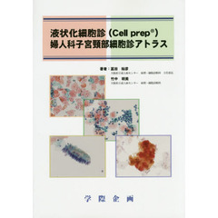 液状化細胞診〈Ｃｅｌｌ　ｐｒｅｐ〉婦人科子宮頸部細胞診アトラス