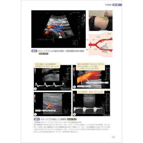 エキスパートの手元がみえる！血管エコー 解剖・正常像で身につく走査テクニックと検査手順、報告書作成まで 通販｜セブンネットショッピング